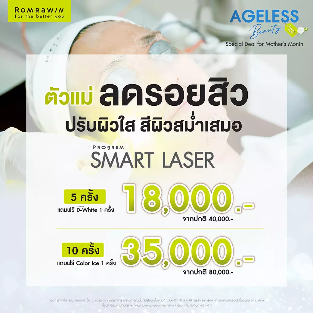 Smart Laser สิงหาคม