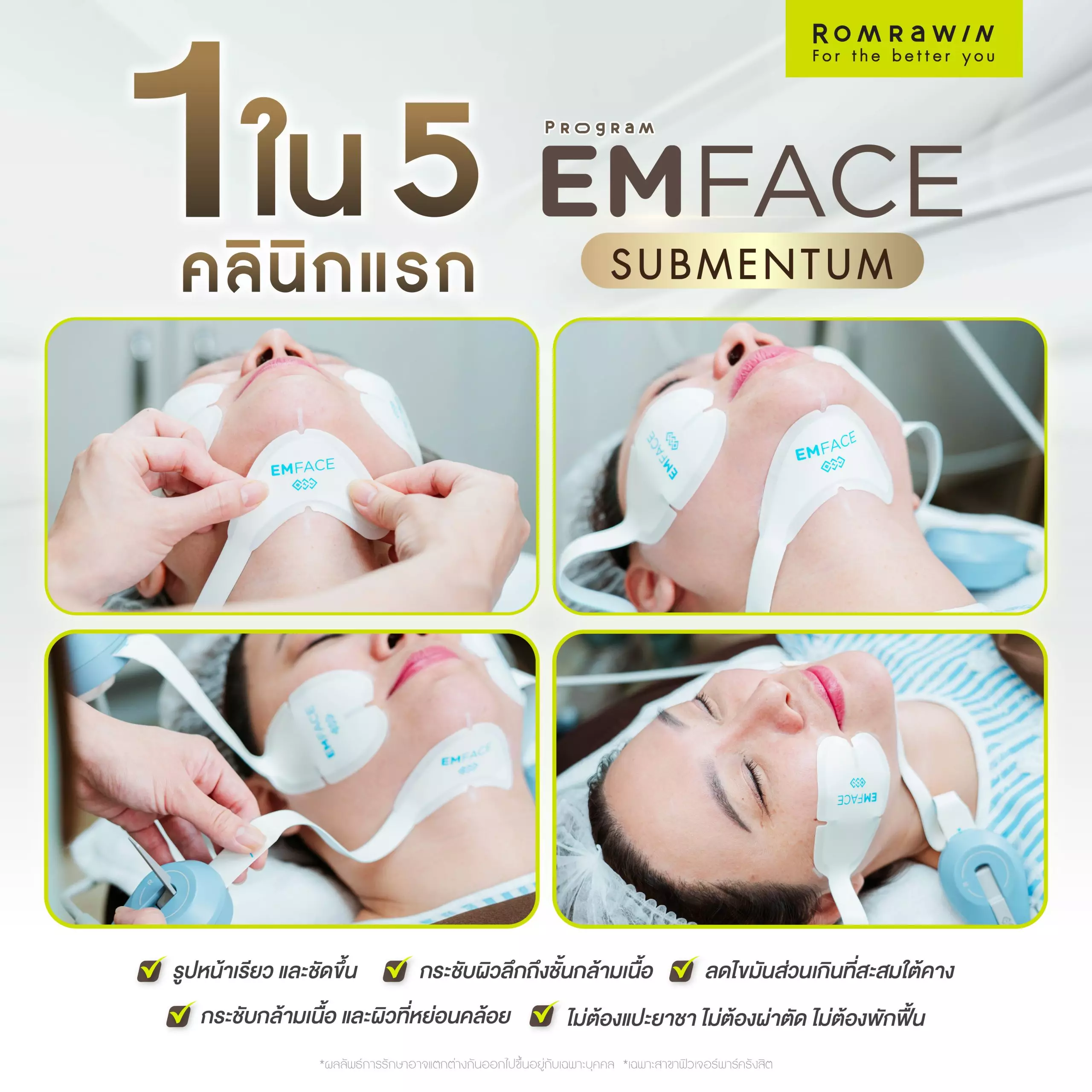 Emface Submentum 