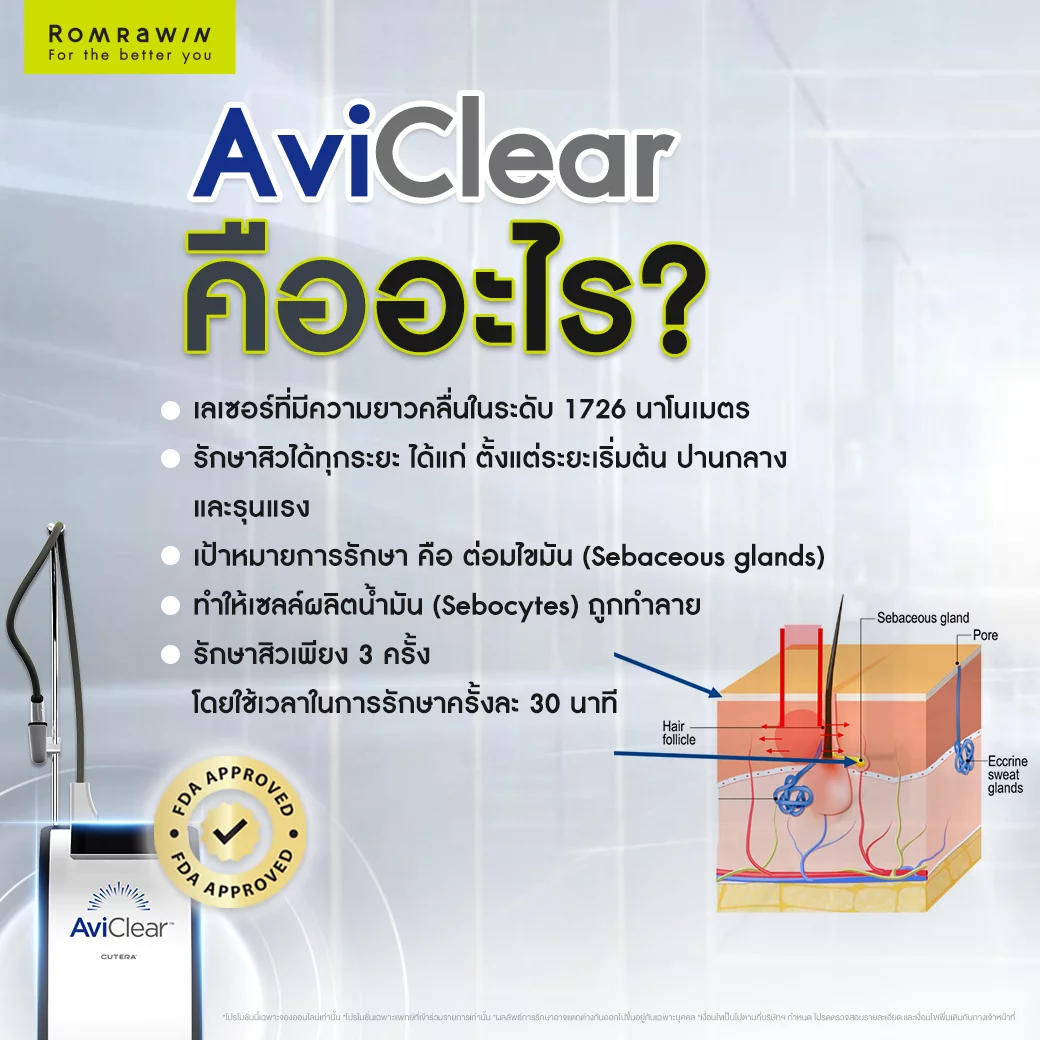 AviClear