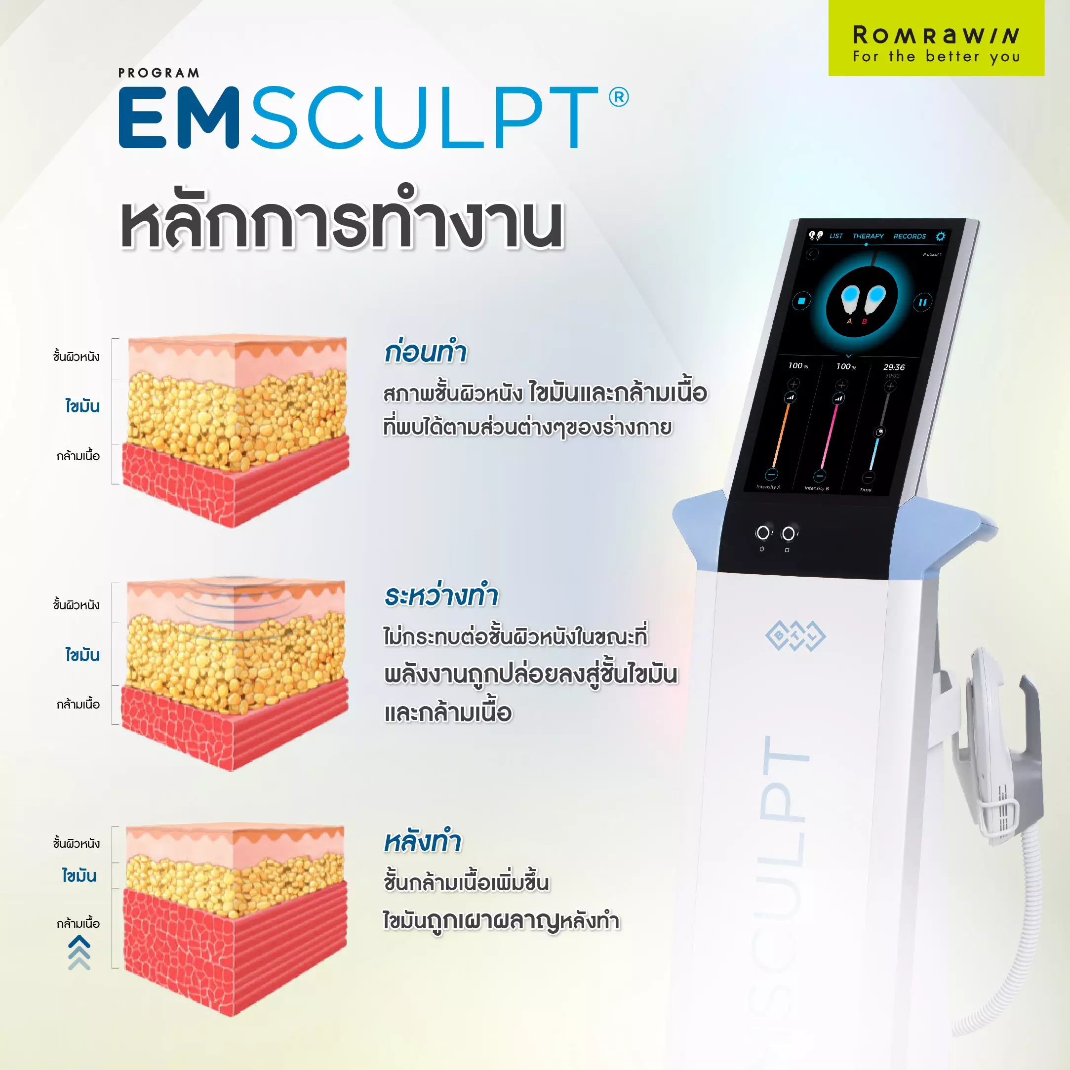 Emsculpt