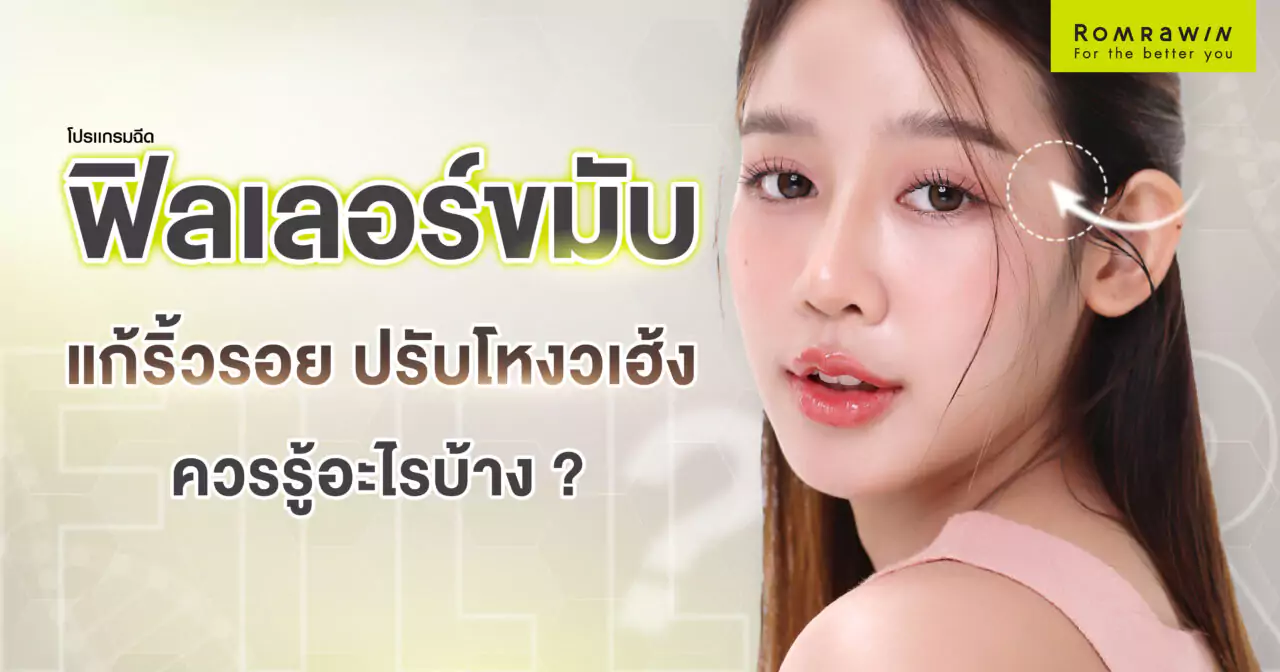 ฟิลเลอร์ขมับ