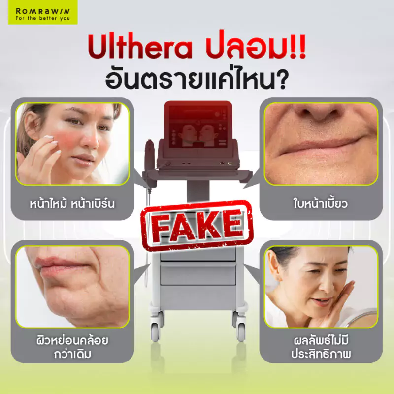 ulthera ปลอม