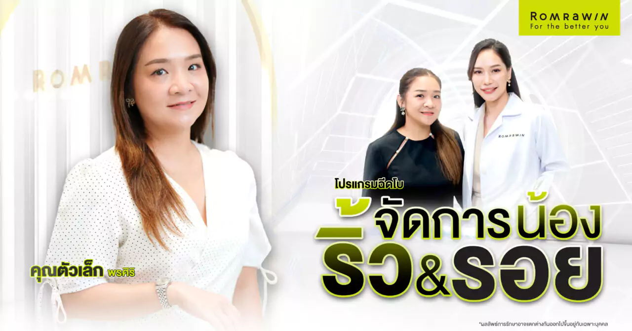 รีวิวโบริ้วรอย