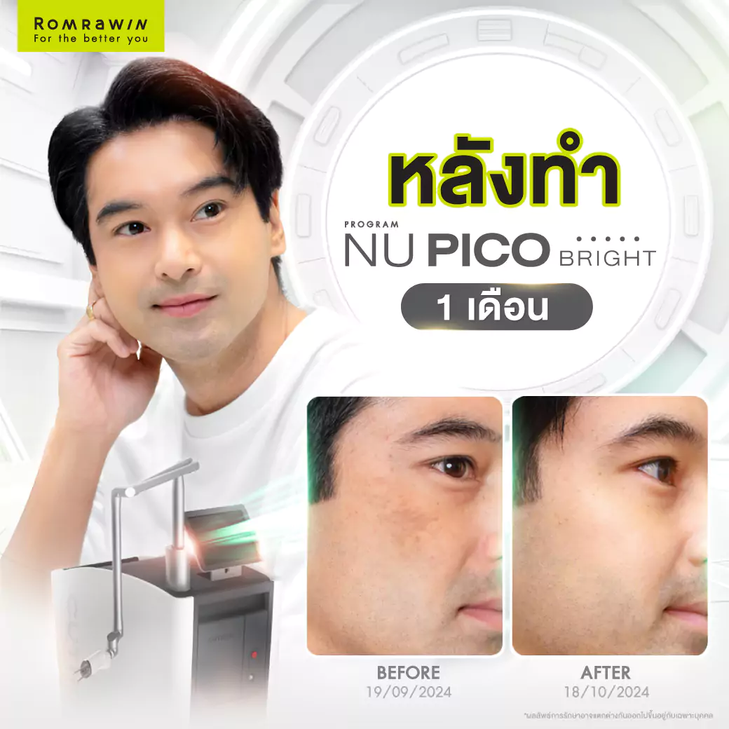 NU PICO BRIGHT