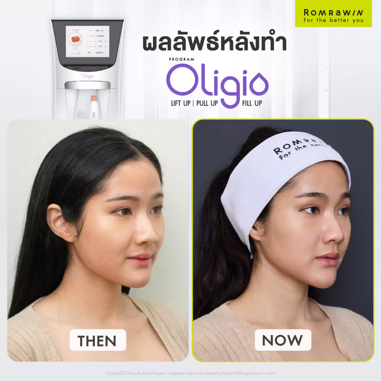 Oligio รีวิว