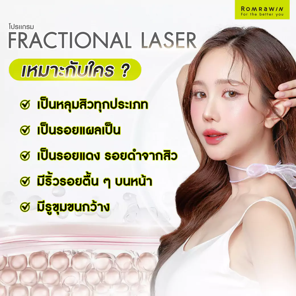 Fractional Laser เหมาะกับใคร