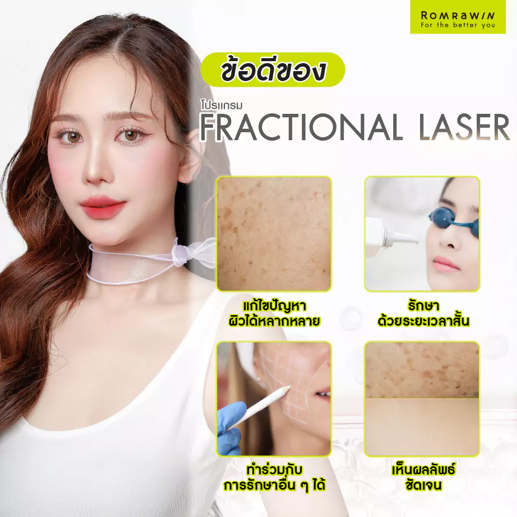 ข้อดีของ Fractional Laser