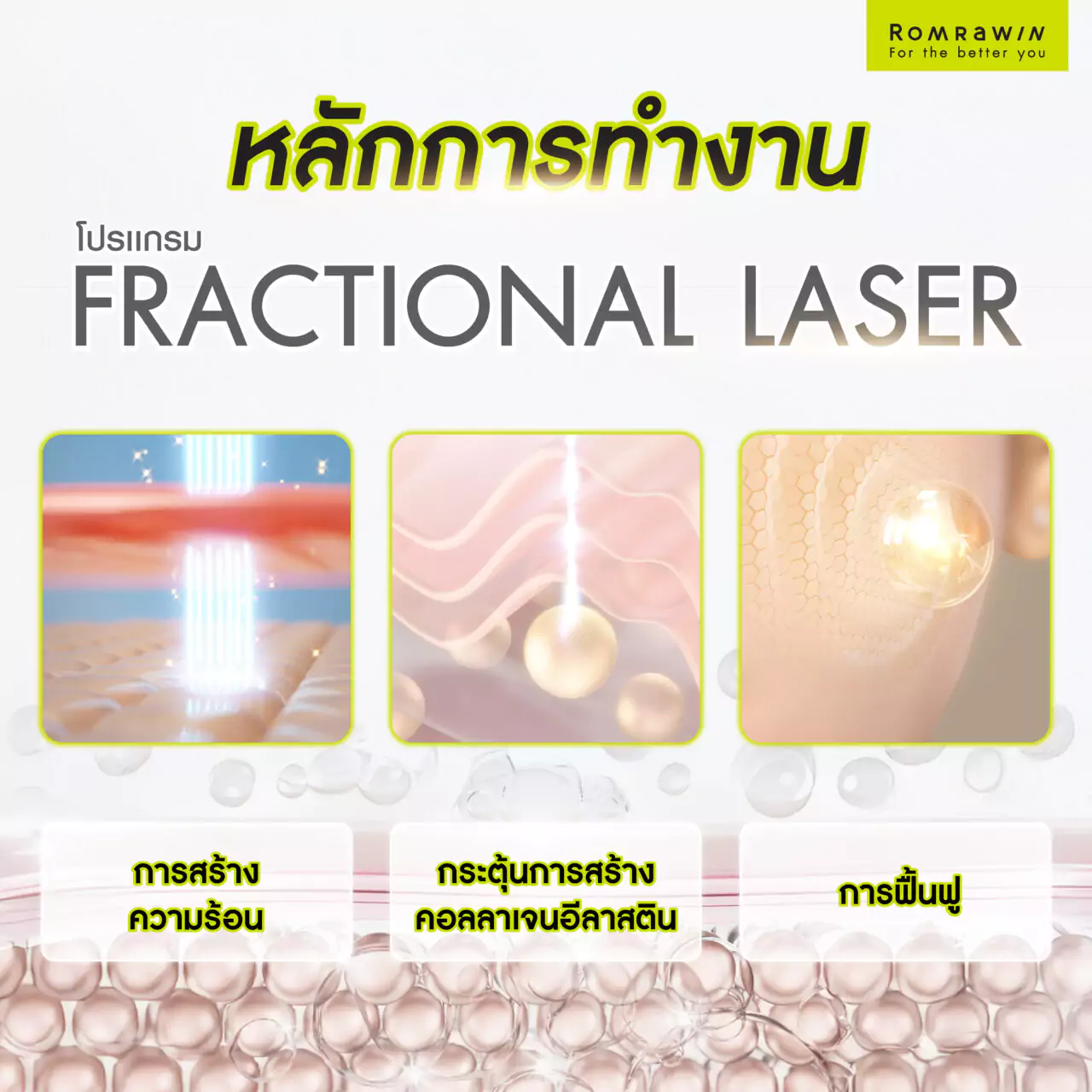 หลักหารทำงาน Fractional Laser