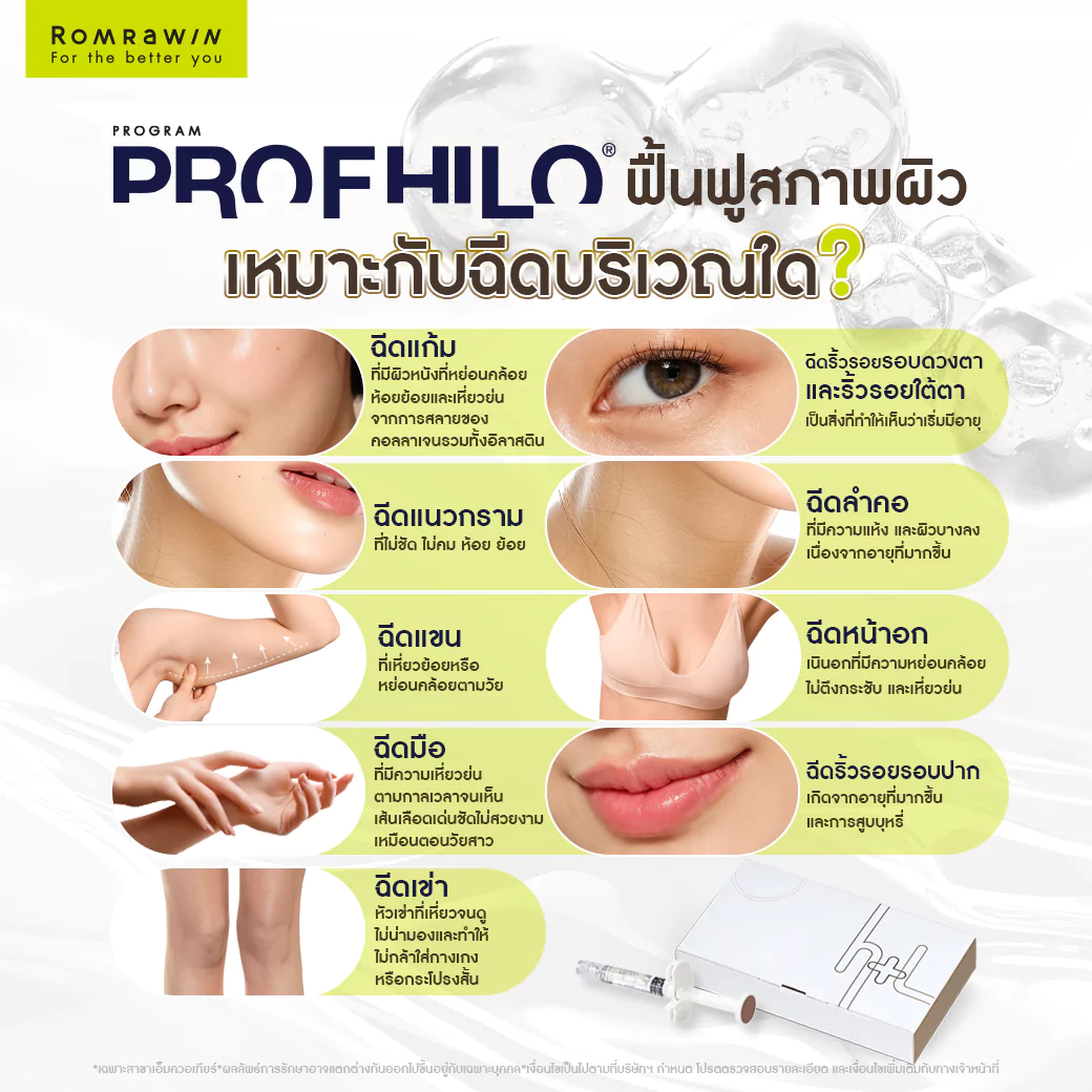 Profhilo เหมาะกับฉีดบริเวณใด