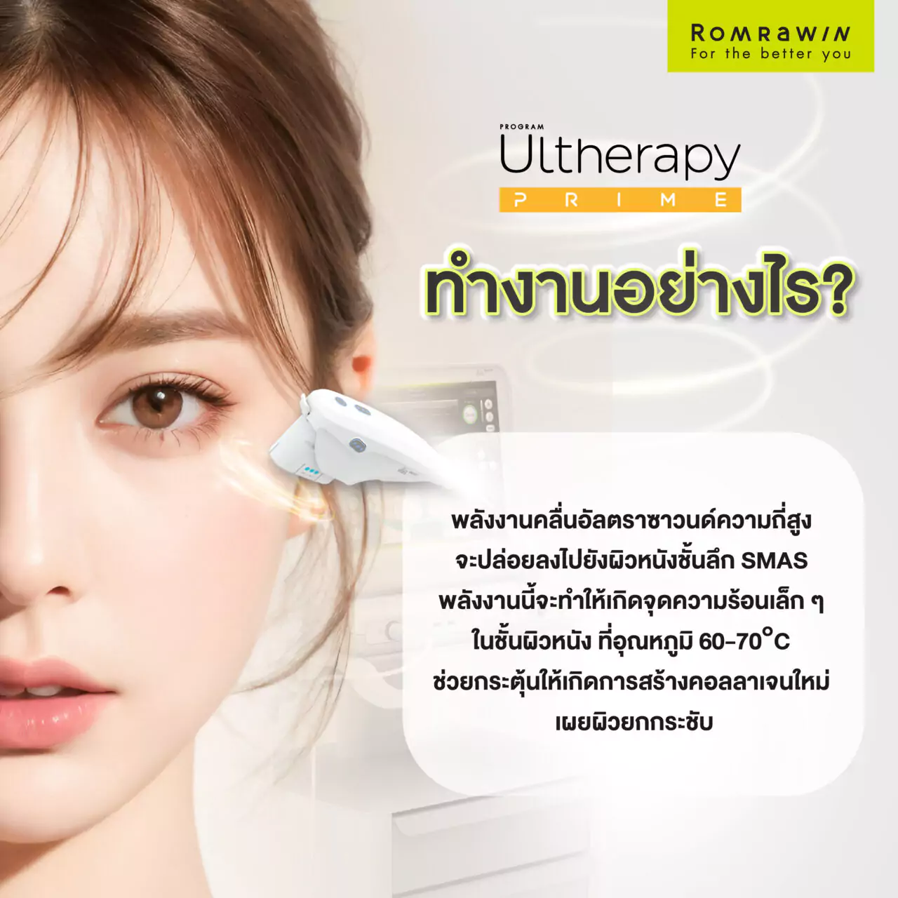 Ultherapy Prime ทำงานอย่างไร