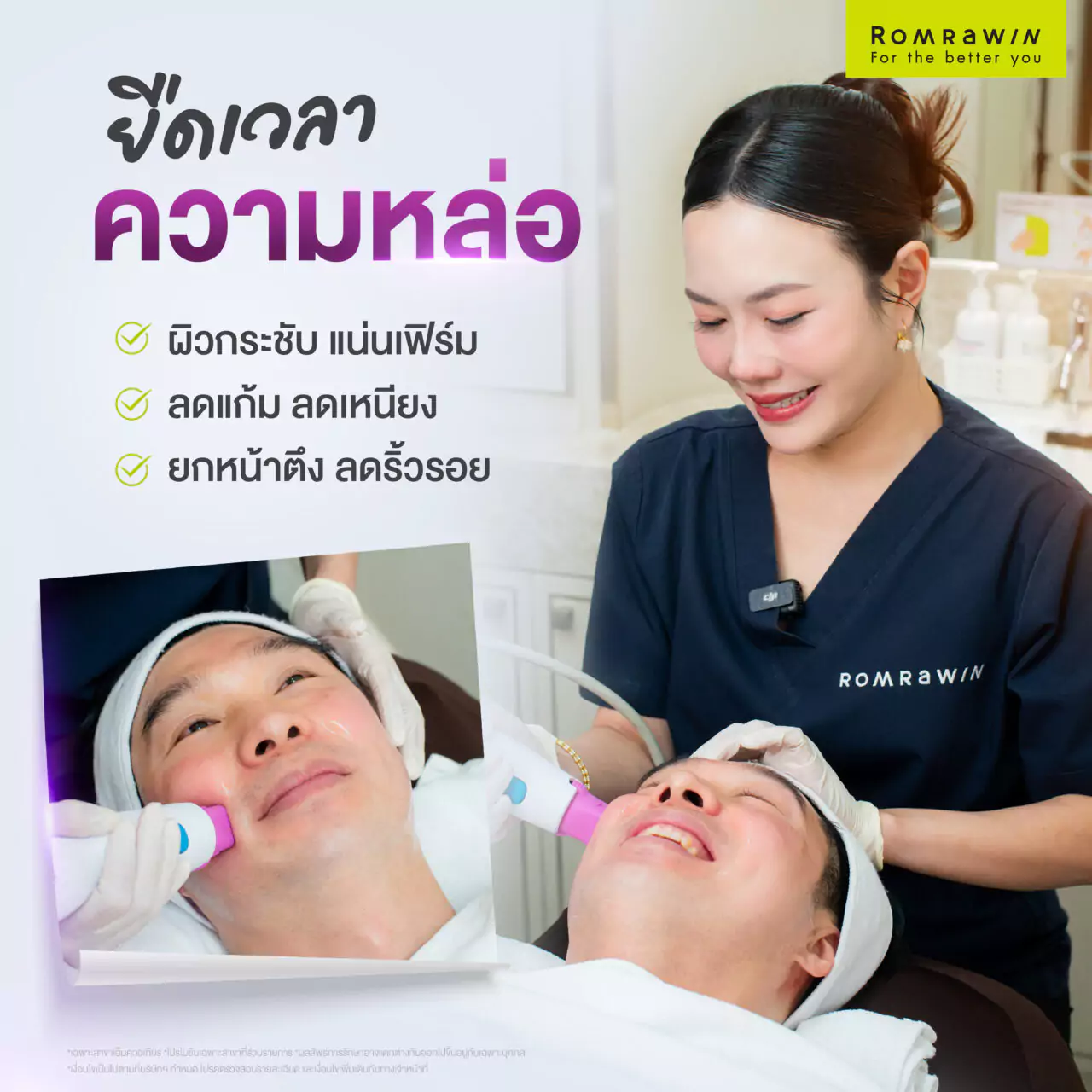 Thermage FLX ยกหน้าตึง