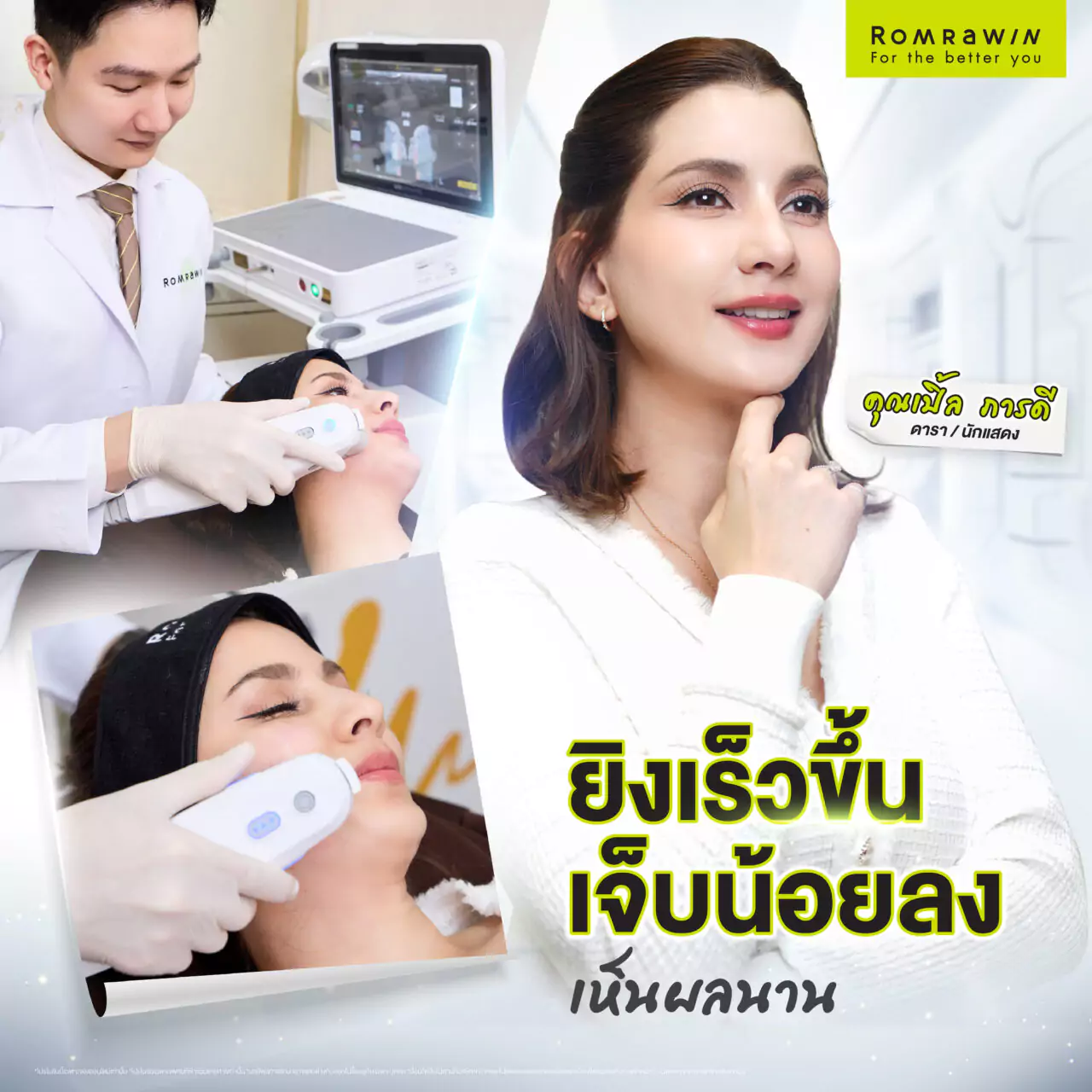 Ultherapy Prime ยิงเร็วขึ้น เจ็บน้อยลง