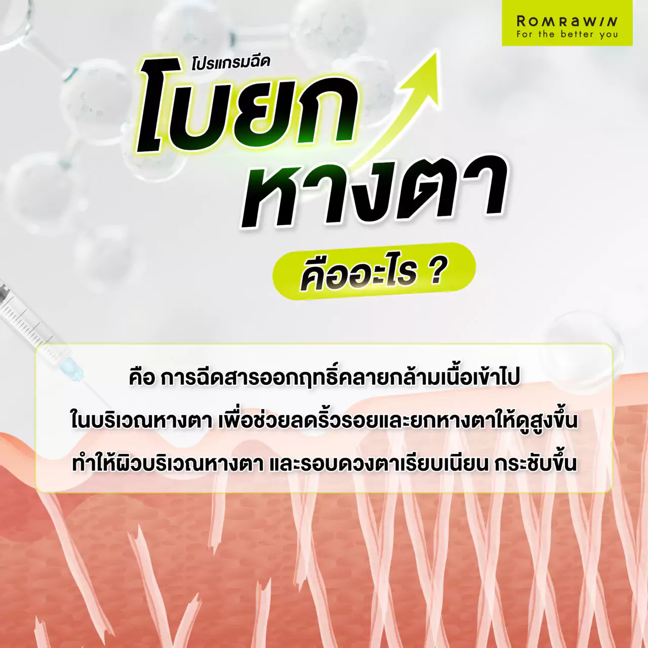 โบยกหางตา คืออะไร