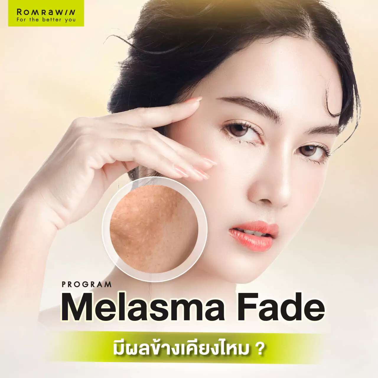 Melasma Fade มีผลข้างเคียงไหม