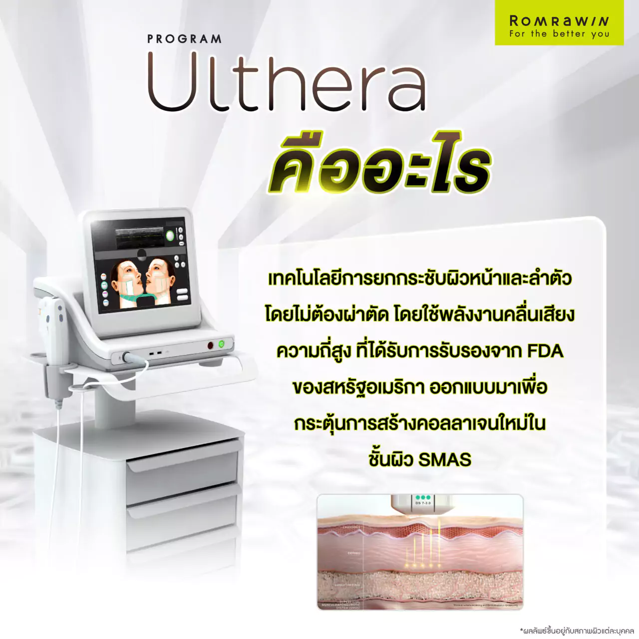 ULTHERA คืออะไร