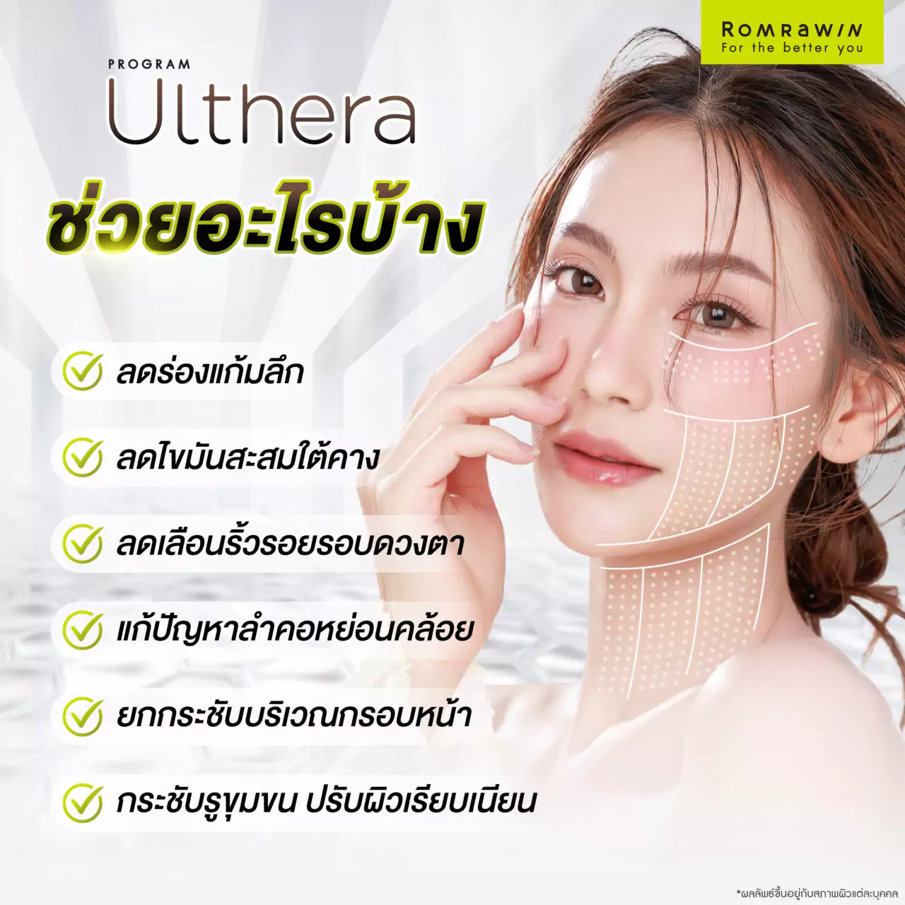 ULTHERA ช่วยอะไรบ้าง