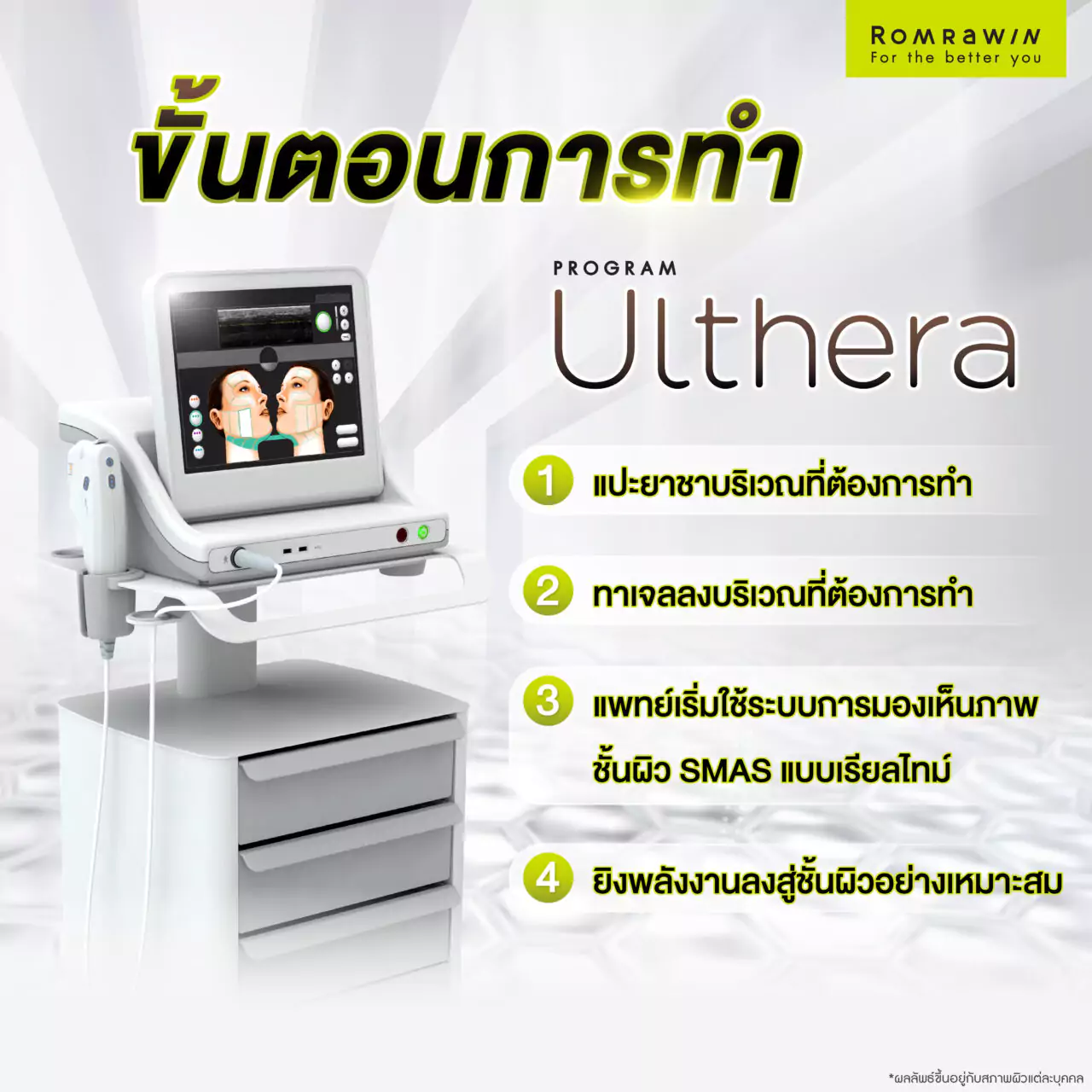 ขั้นตอนการทำ ULTHERA