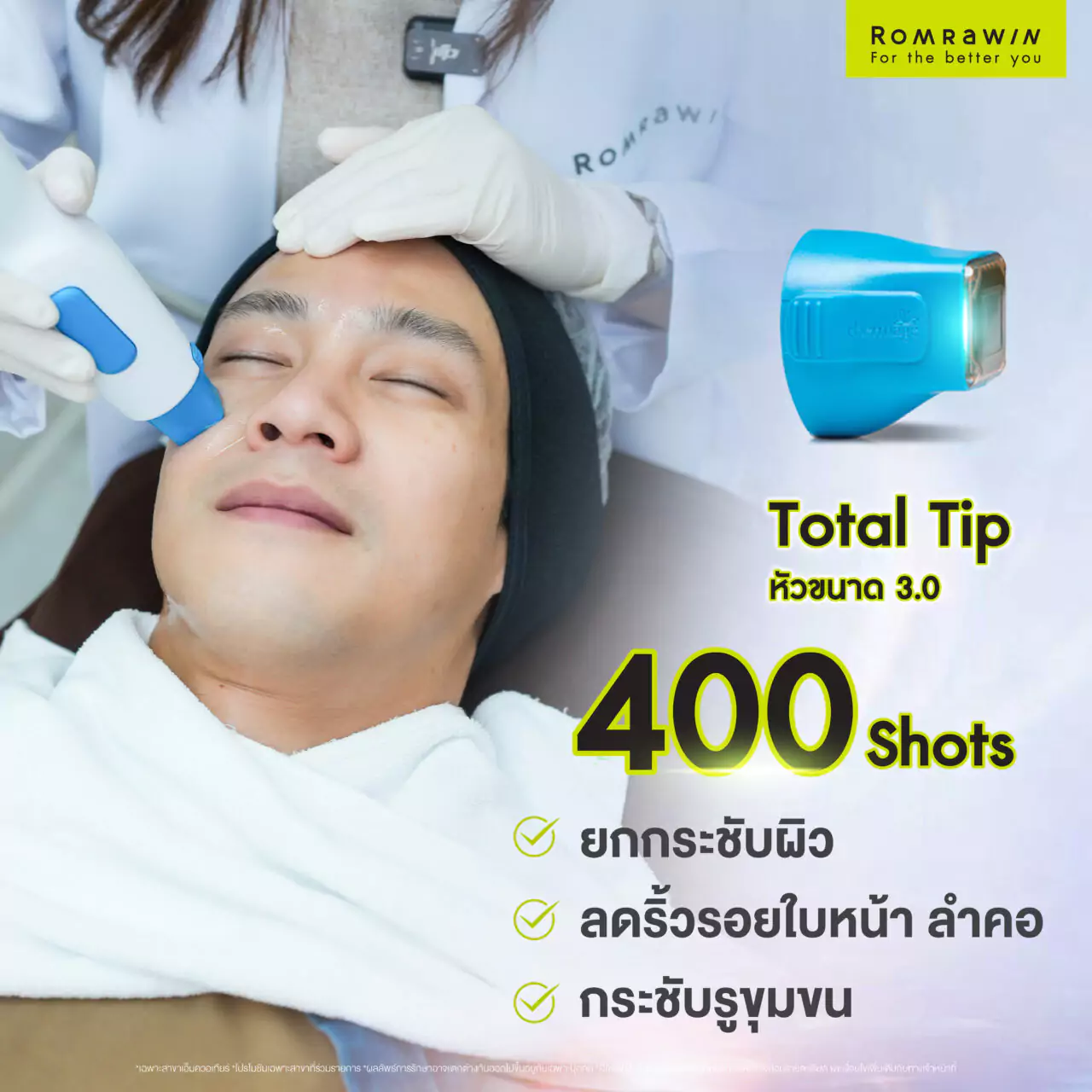 Thermage FLX ผลลัพธ์ขึ้นอยู่กับบุคคล