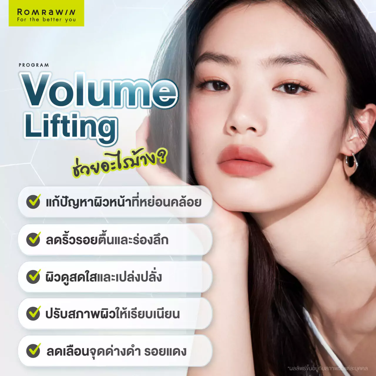 ข้อดีของการยกกระชับผิวหน้า Volume Lifting