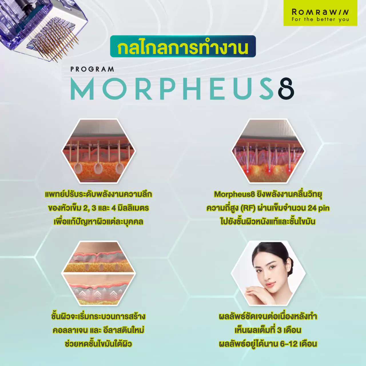 Morpheus8 กู้ผิวยับ หย่อนคล้อย ทำงานอย่างไร?