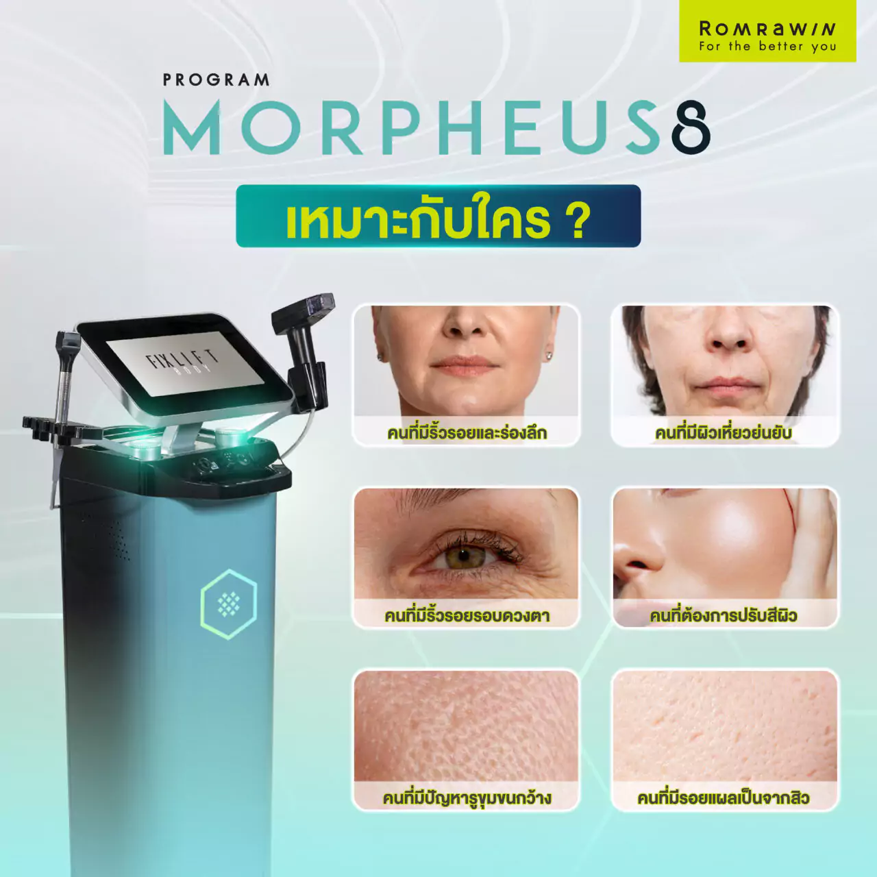 Morpheus8 กู้ผิวยับ หย่อนคล้อย เหมาะกับใคร?