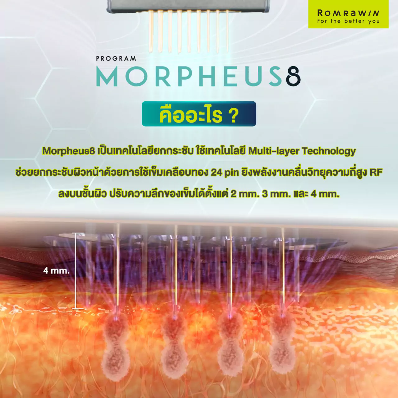 Morpheus8 กู้ผิวยับ หย่อนคล้อย คืออะไร