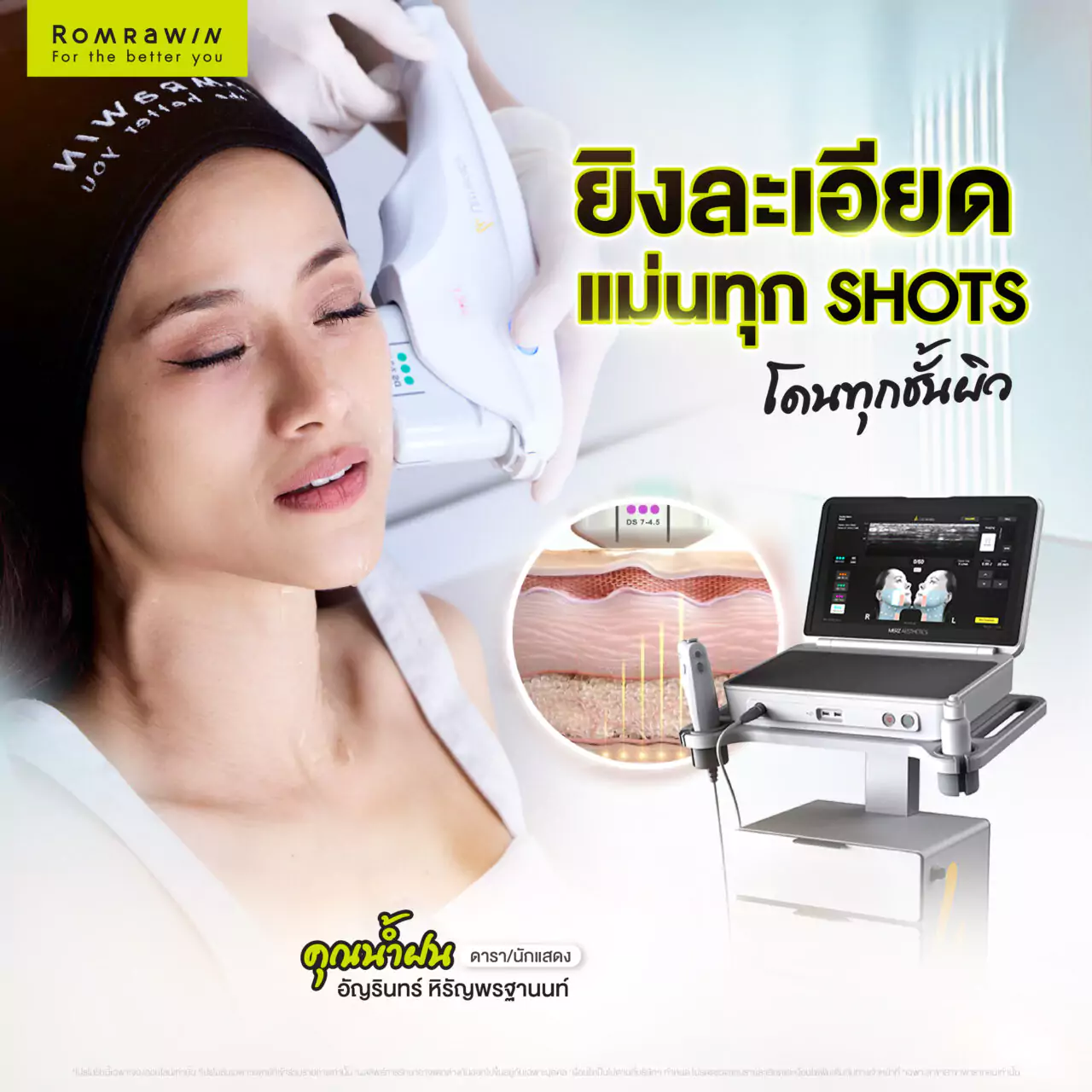 Ultherapy PRIME ยกกระชับผิว