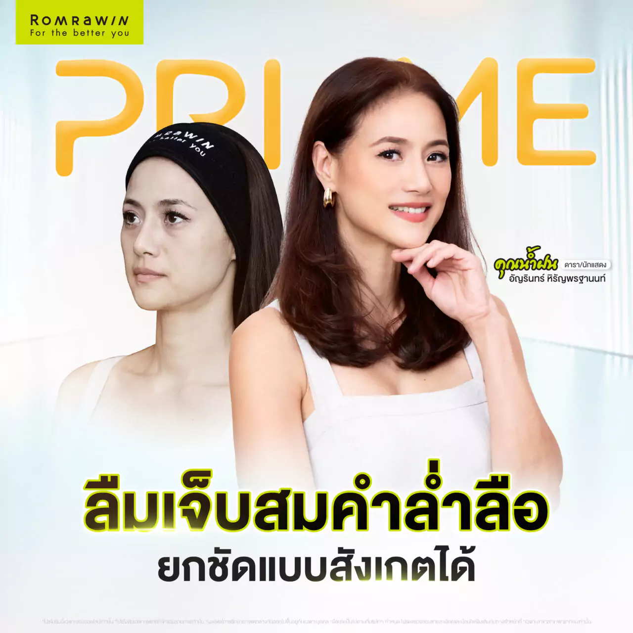 Ultherapy PRIME ยกกระชับผิว