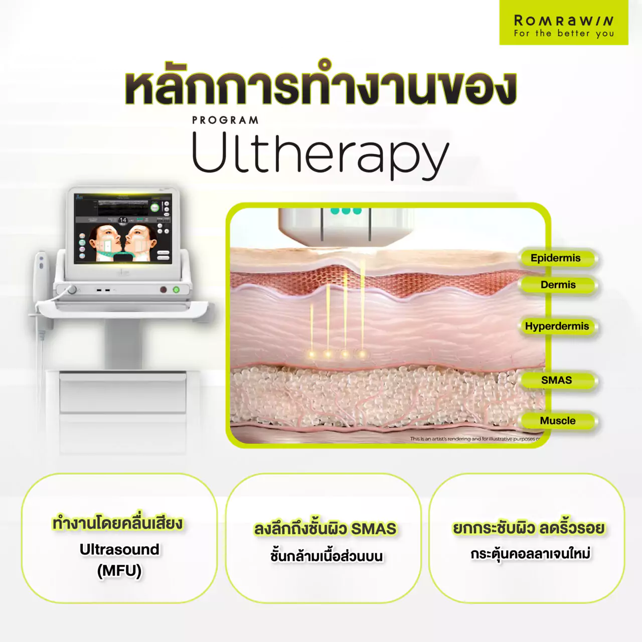 หลักการทำงานของยกกระชับผิวหน้า Ultherapy 