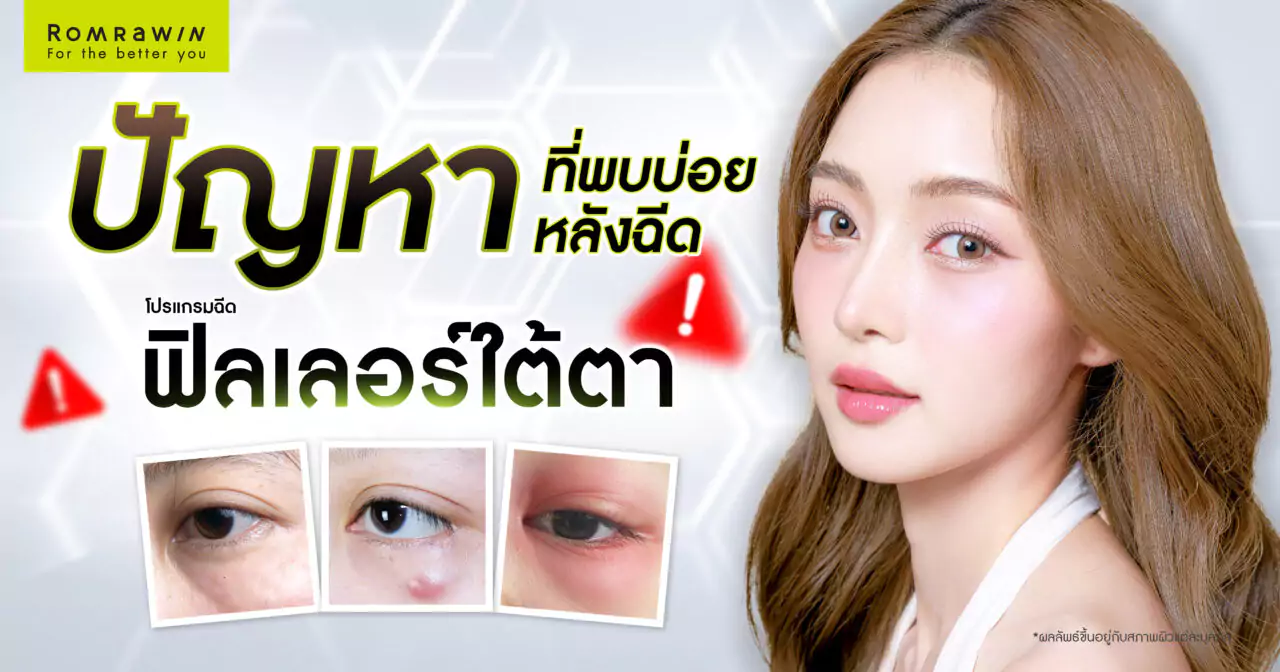 ฟิลเลอร์ใต้ตา