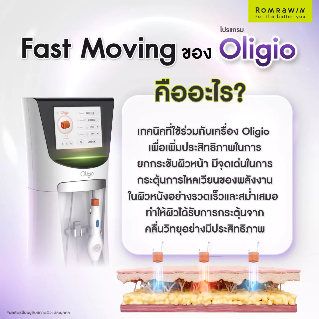 ทำความรู้จักโปรแกรม Oligio และเทคนิค Fast Moving ที่ทุกคนพูดถึง