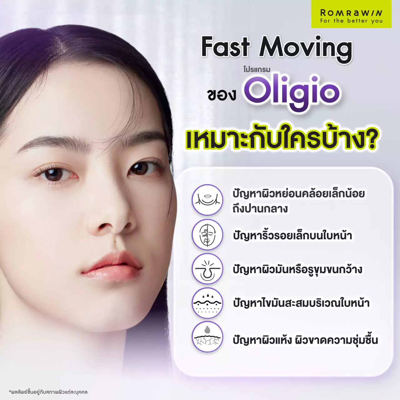 เทคนิค Fast Moving ของโปรแกรม Oligio เหมาะและไม่เหมาะกับใคร?