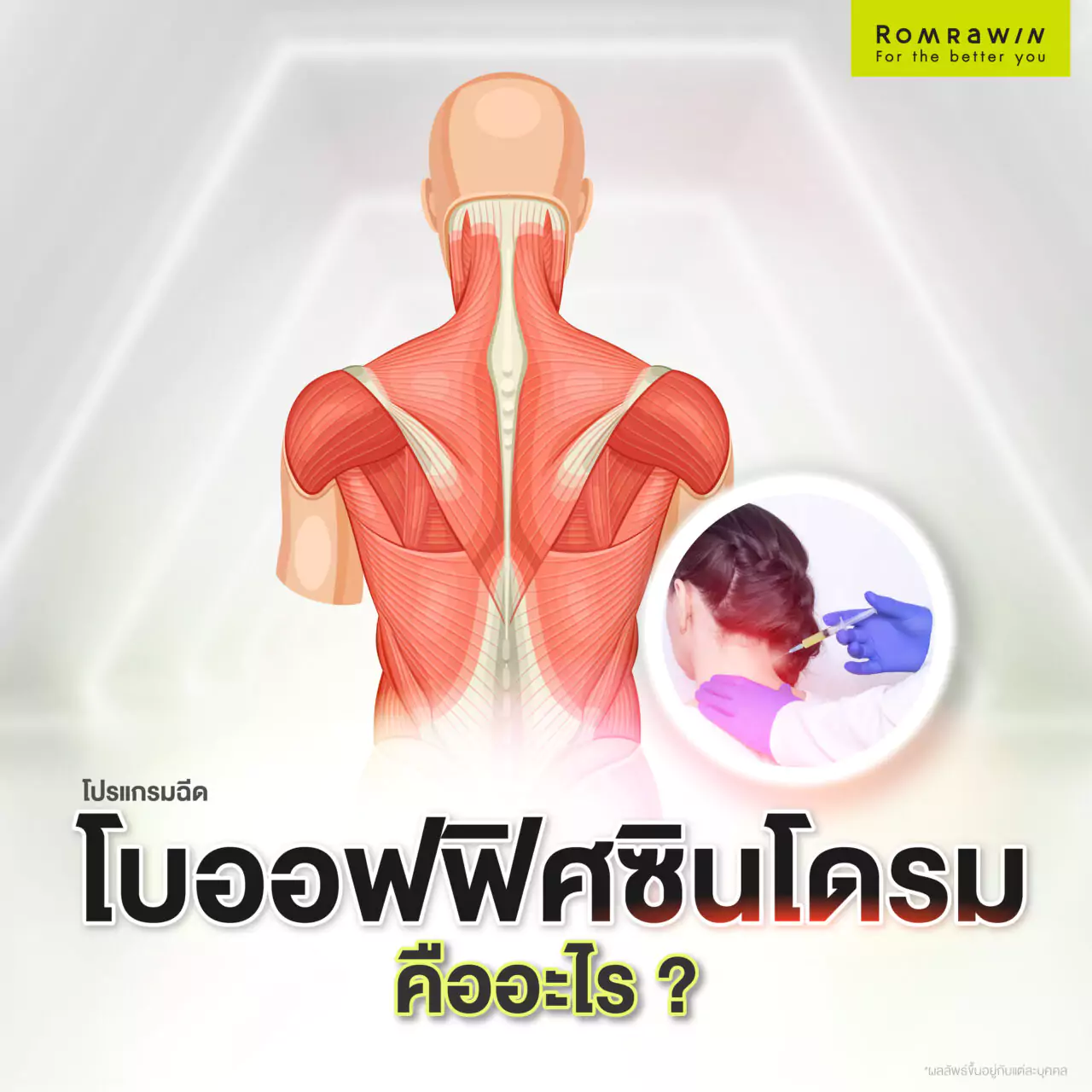 โปรแกรมฉีดโบออฟฟิศซินโดรม คืออะไร? เหมาะกับใคร?