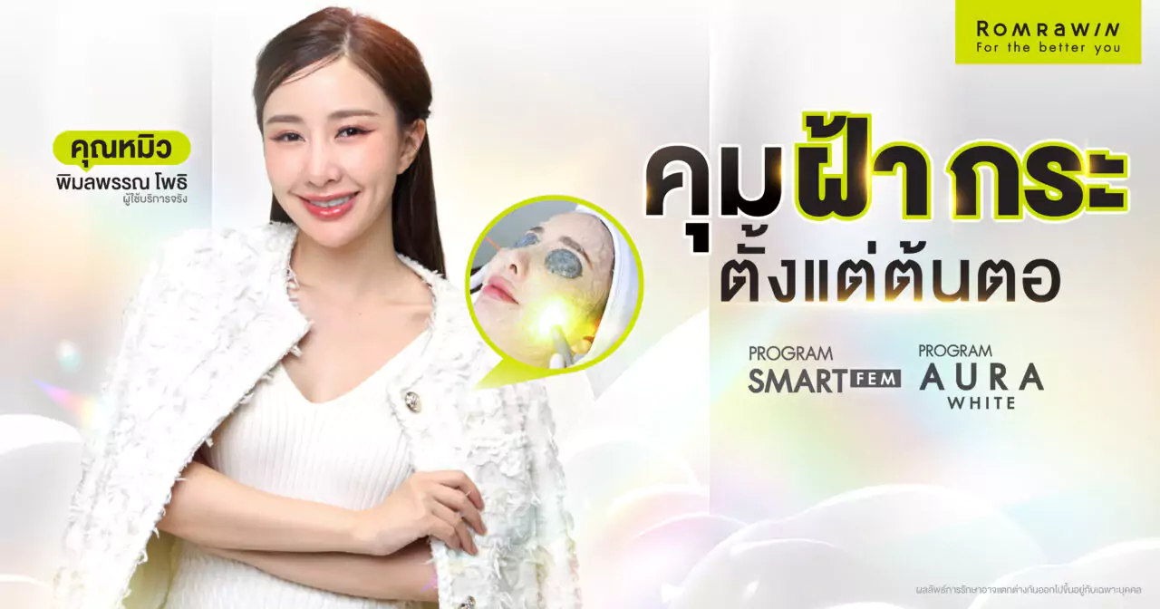 คุมฝ้า กระ ได้อยู่หมัดด้วย SMART FEM และ AURA WHITE ที่รมย์รวินท์คลินิก 1 คุมฝ้า กระ