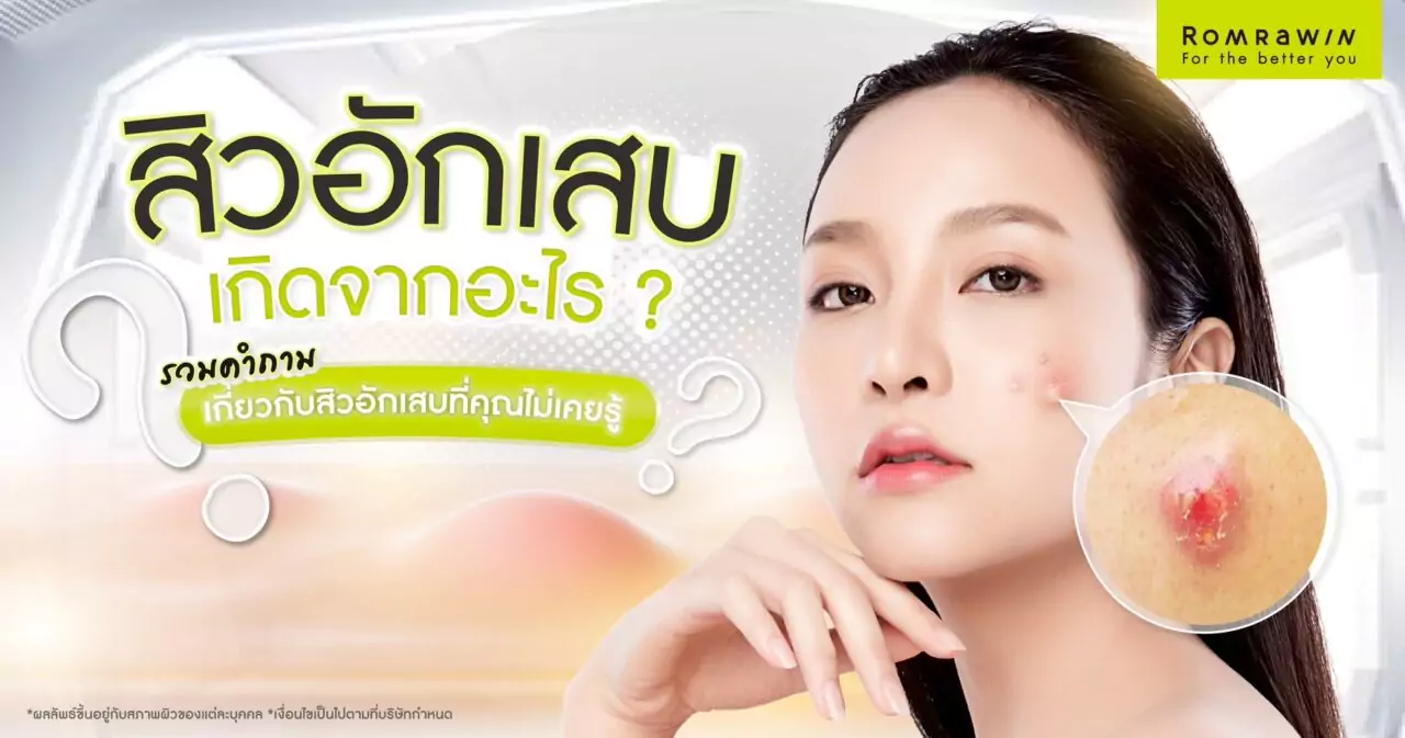 สิวอักเสบเกิดจากอะไร ?