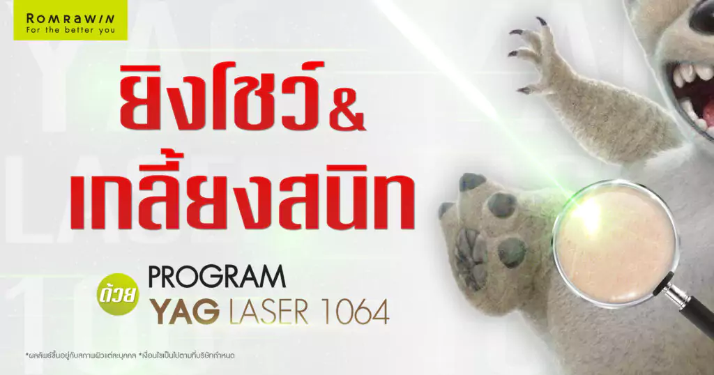 Stitch ปรับลุคใหม่ สู่ภารกิจผิวเนียนใสด้วย YAG LASER 1064 