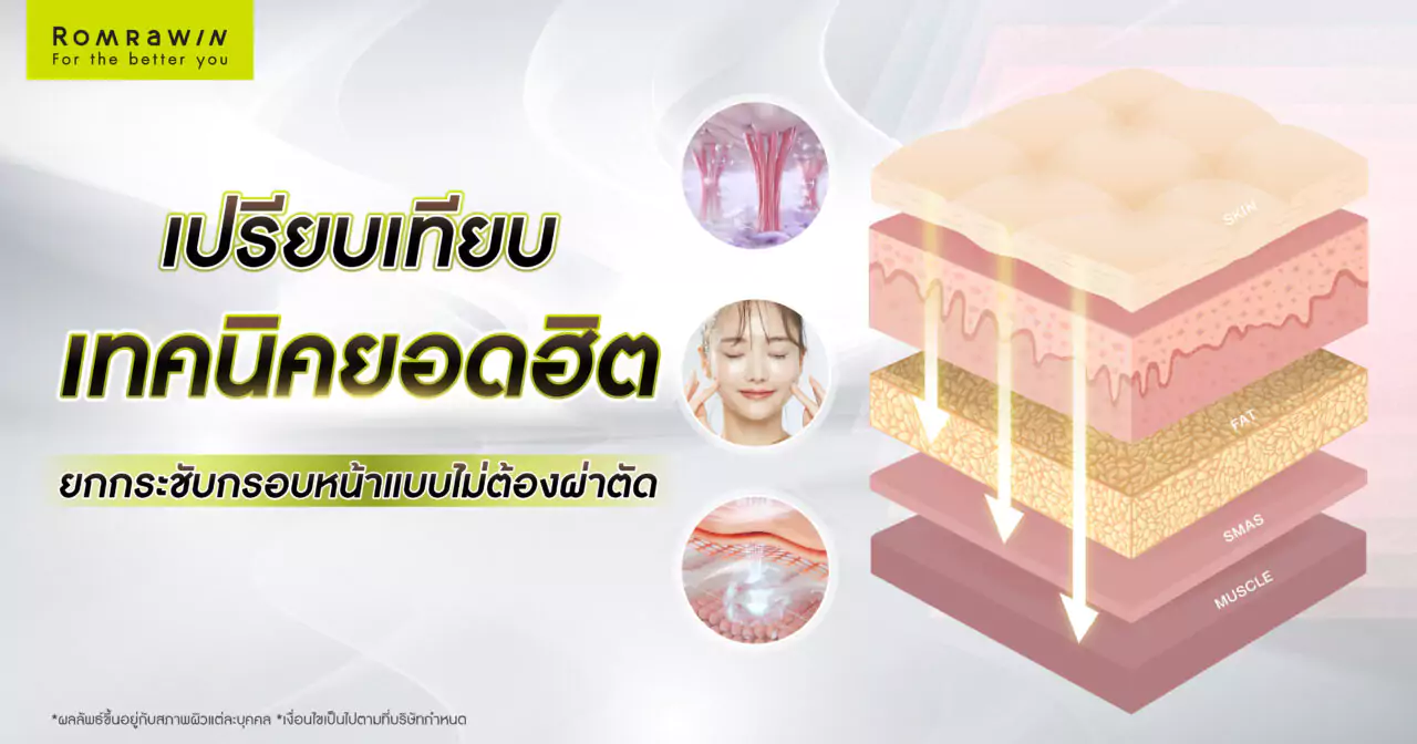 ยกกระชับกรอบหน้าแบบไม่ต้องผ่าตัด วิธีไหนดี? 2 ยกกระชับกรอบหน้าแบบไม่ต้องผ่าตัด วิธีไหนดี?