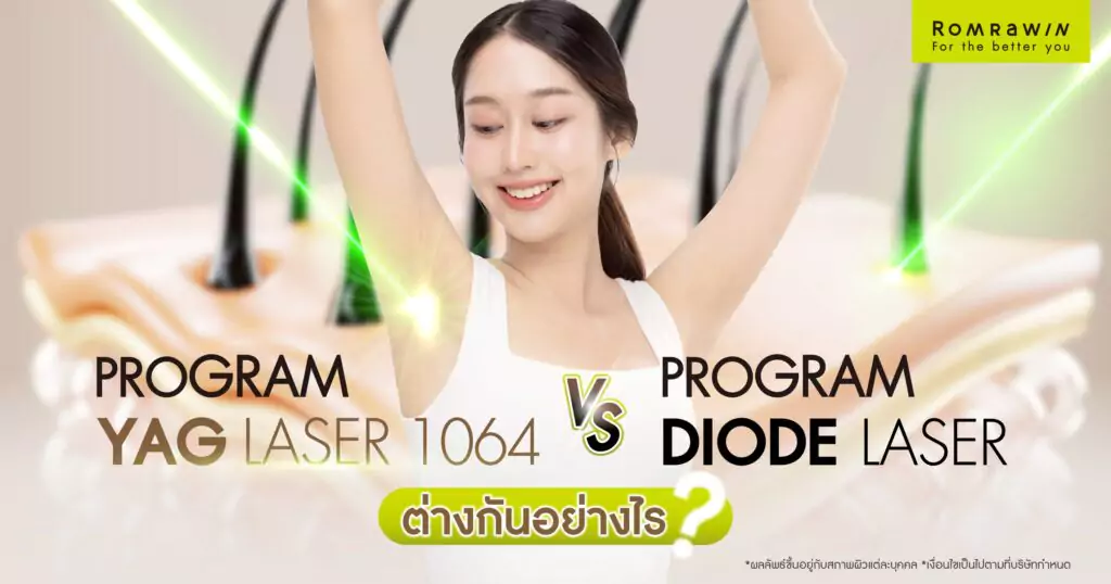 เทียบชัดเลเซอร์กำจัดขน YAG Laser กับ Diode Laser ต่างกันอย่างไร ? 1 เทียบชัดเลเซอร์กำจัดขนยอดฮิต YAG Laser กับ Diode Laser ต่างกันอย่างไร ?