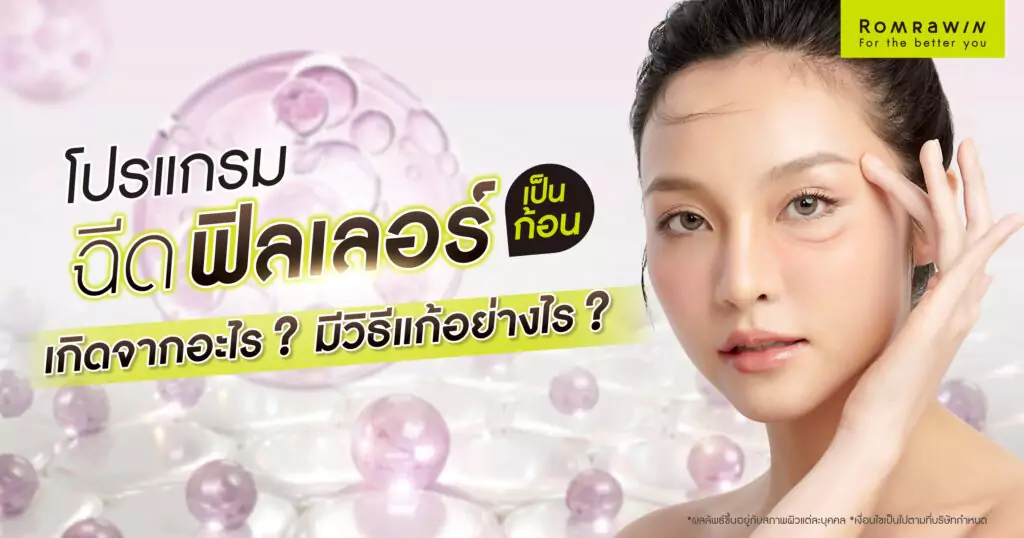 ฉีดฟิลเลอร์แล้วเป็นก้อนทำอย่างไร? เกิดจากอะไร? อันตรายไหม? 1 ฉีดฟิลเลอร์แล้วเป็นก้อนทำอย่างไร