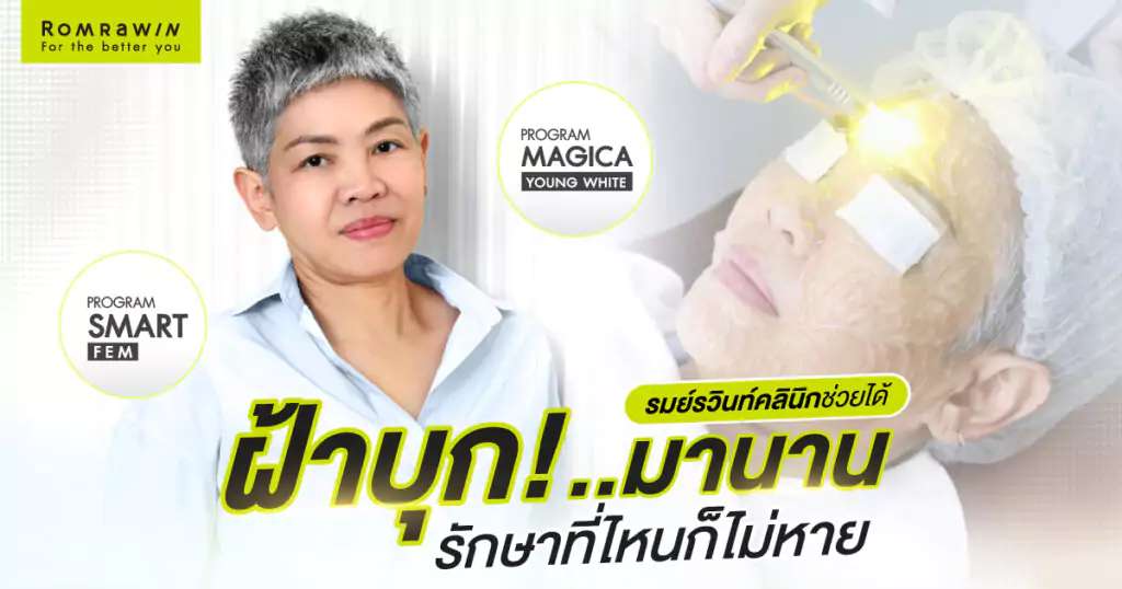 SMART FEM และ MAGICA YOUNG WHITE คุณฝน สิรินธร 3 SMART FEM และ MAGICA YOUNG WHITE คุณฝน สิรินธร