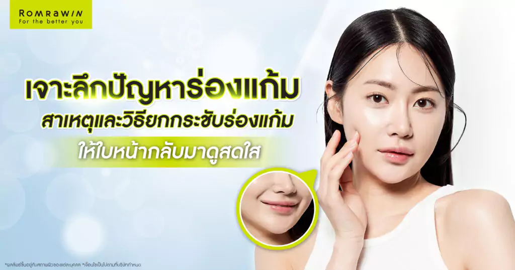ลดร่องแก้ม ยกกระชับใบหน้า ทำให้ร่องแก้มตื้น กลับมาดูอ่อนวัย 1 ปัญหาร่องแก้มลึก