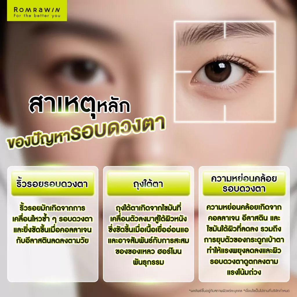 เข้าใจปัญหารอบดวงตา ริ้วรอยใต้ตา ถุงใต้ตา และความหย่อนคล้อย