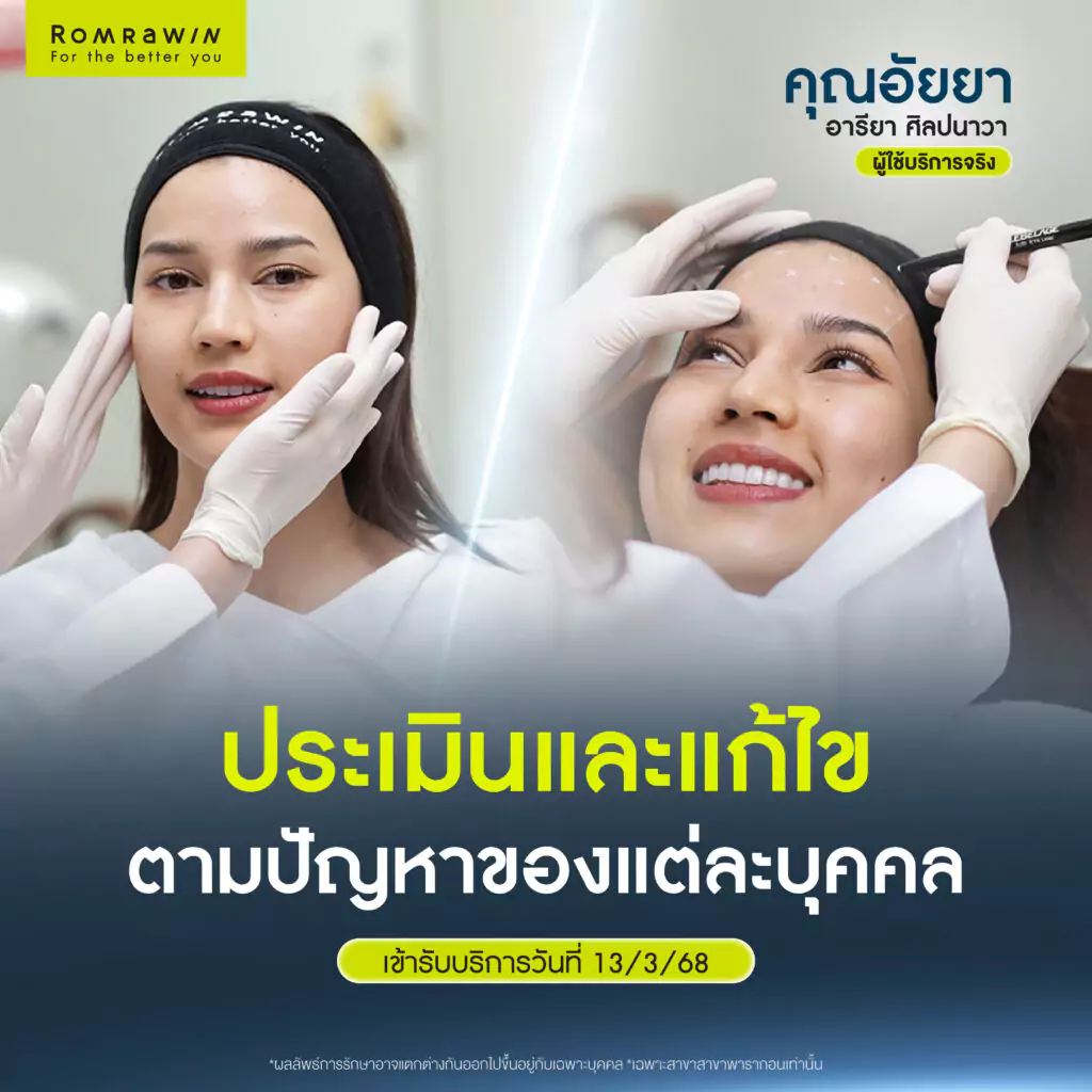 รวบตึง 3 ตัวท็อป โปรแกรมหน้ายุงที่คุณอัยยาเลือก