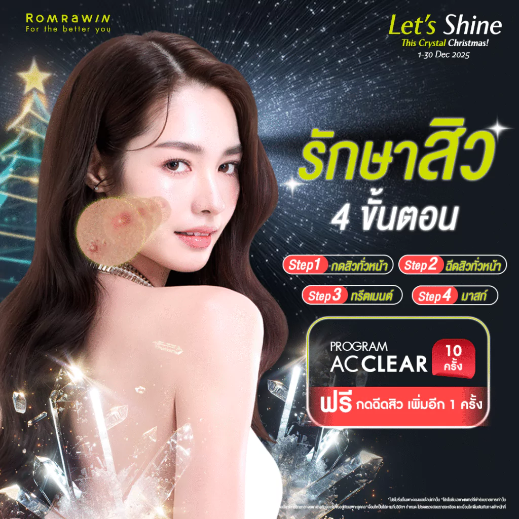 Let’s Shine..รักษาสิว 4 ขั้นตอน 