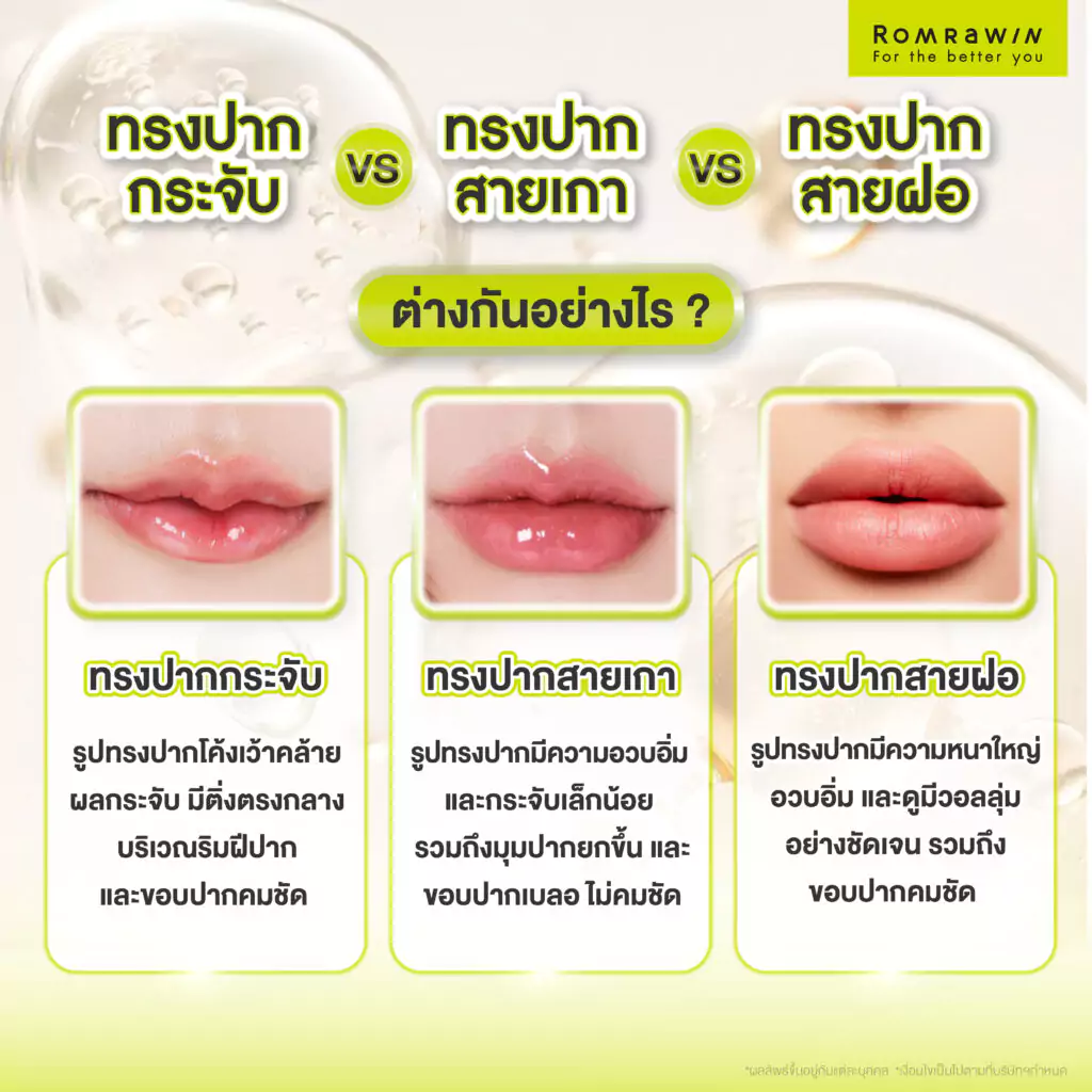 ทรงปากยอดนิยม เลือกอย่างไรให้เหมาะกับหน้า? รู้ลึกก่อนฉีดฟิลเลอร์ปาก 3 ทรงปากกระจับ กับ ทรงปากสายเกา กับ ทรงปากสายฝอต่างกันอย่างไร?