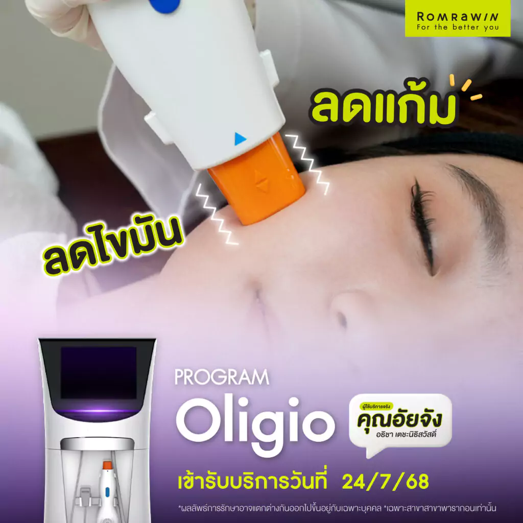 Oligo เติมเสน่ห์หน้าวีเชพให้ คุณอัยจัง 2 Oligo เติมเสน่ห์หน้าวีเชพให้ คุณอัยจัง