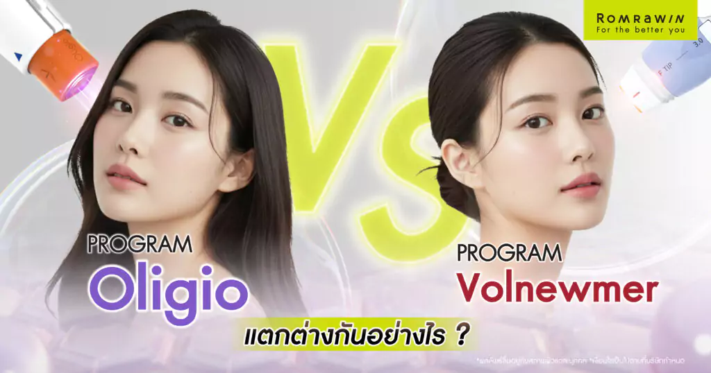 Oligio กับ Volnewmer แตกต่างกันอย่างไร