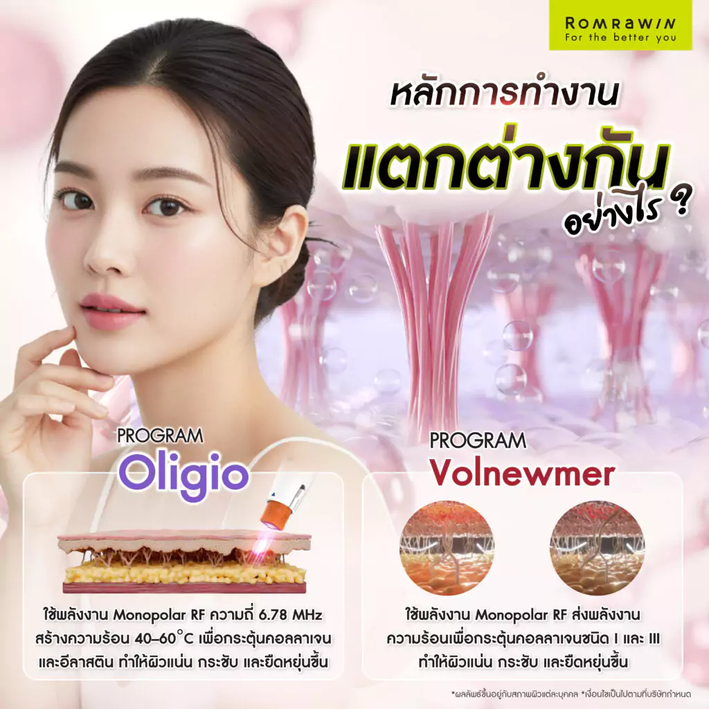 หลักการทำงานของ Oligio กับ Volnewmer แตกต่างกันอย่างไร?