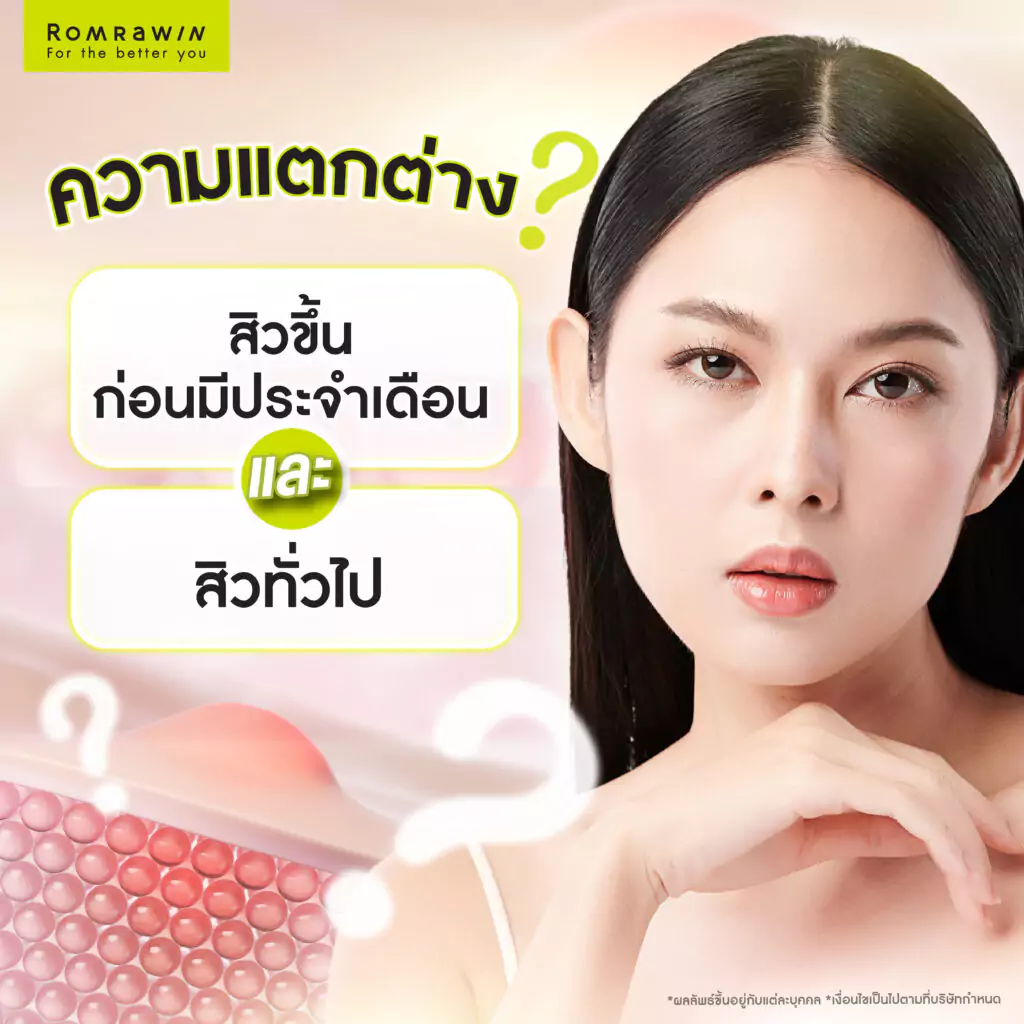 ความแตกต่างระหว่างสิวขึ้นก่อนมีประจำเดือนกับสิวทั่วไป