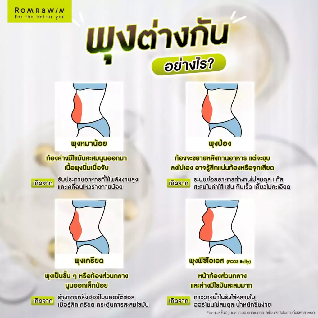 พุงหมาน้อย ต่างจาก พุงป่อง พุงเครียด และพุงพีซีโอเอส อย่างไร